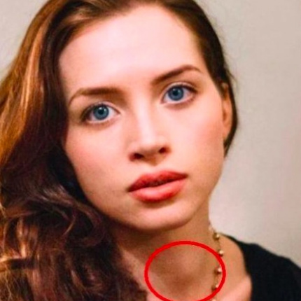 Pewna aktorka ostrzega przed rakiem tarczycy. Jej zdjęcie obiegło sieć, fot. Twitter @LornaNBrown