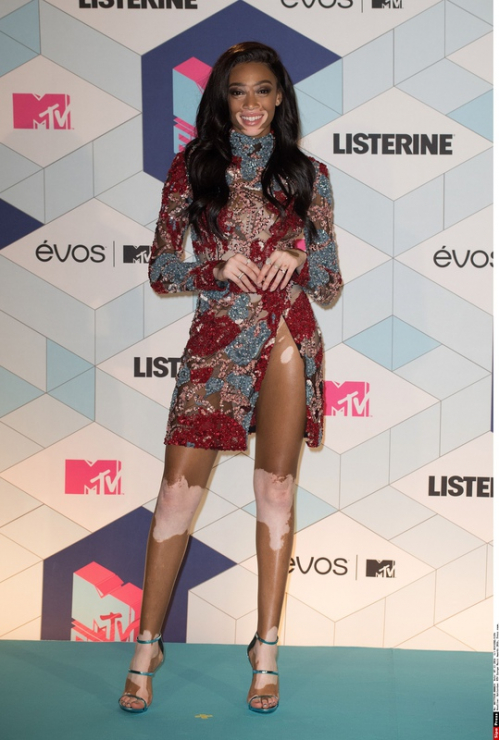 MTV EMA 2016, Winnie Harlow